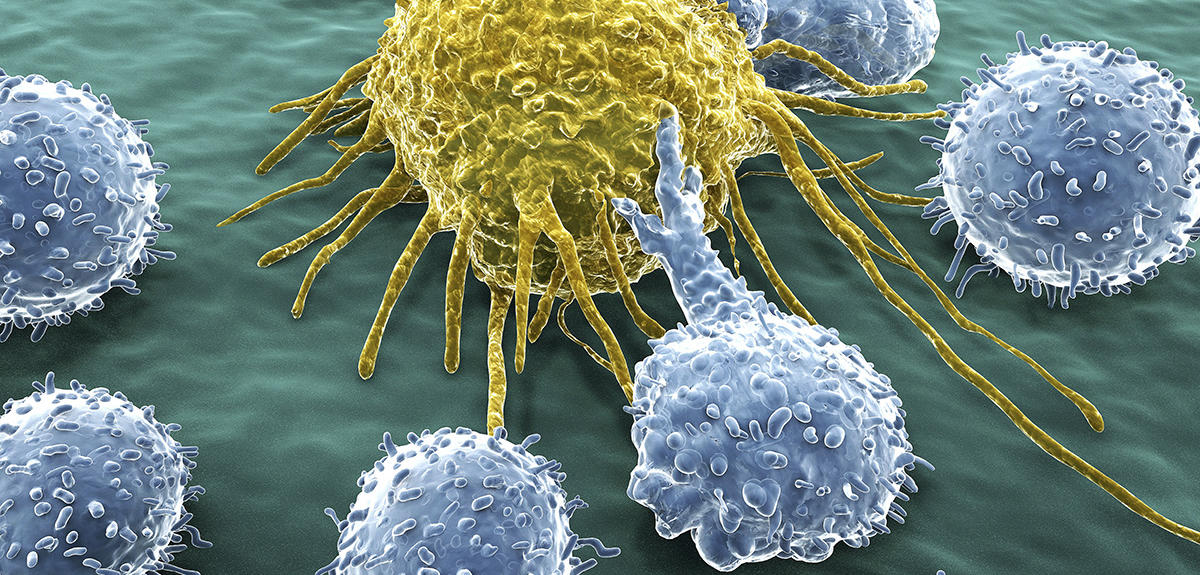 Le paradoxe de la chimiothérapie sur la dissémination des cellules cancéreuses !
